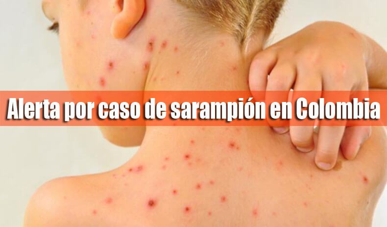 El Instituto Nacional de Salud- INS-, informó que al 30 de octubre del presente año, se    reportaron 149 casos de sarampión en el territorio nacional.